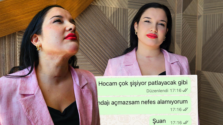 Estetik Operasyonundan Dönen Kadın 5 Milyon Lira Tazminat Talep Ediyor