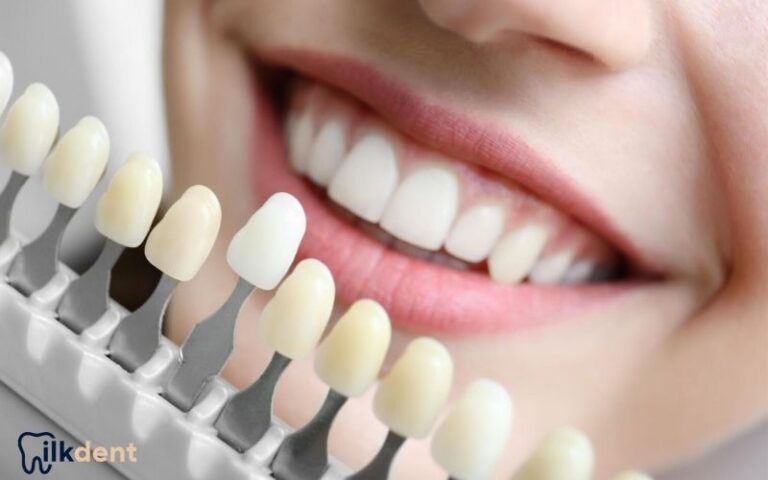 Bayrampaşa Lamine Kaplama ile Estetik Gülüşler