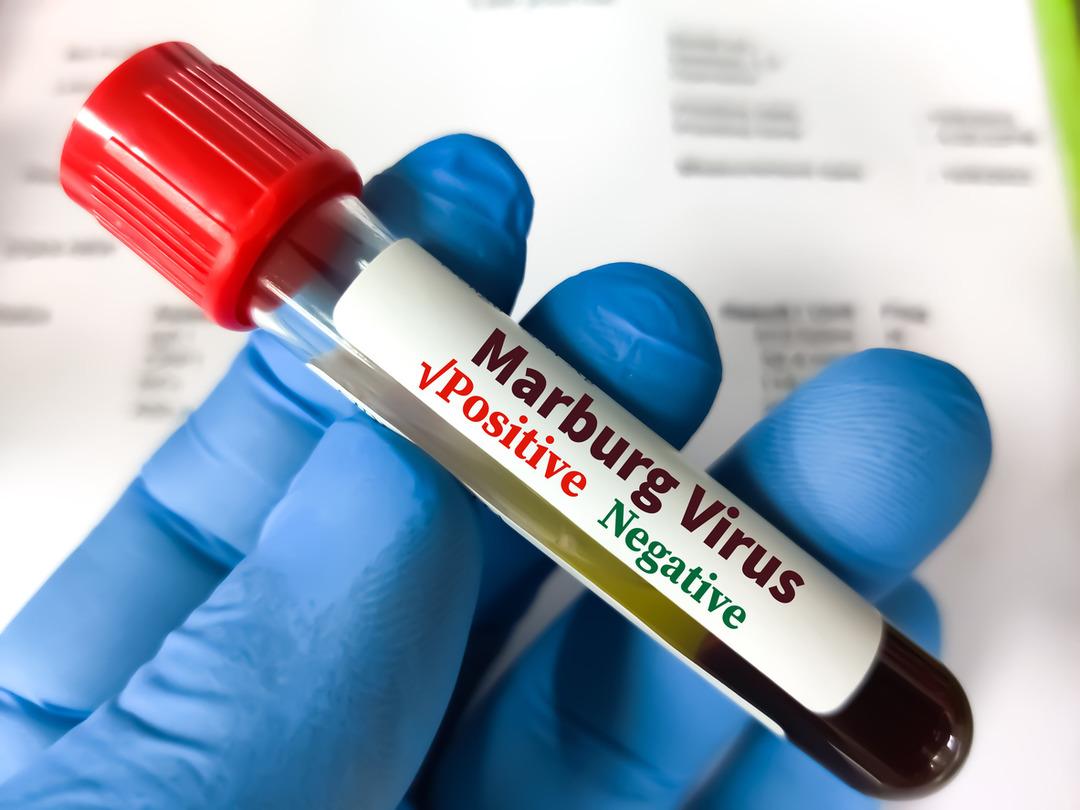 Korkunç Hastalık: Resmi olarak içeriden çürütüyor! Ebola virüsü 8 kişinin hayatını aldı 2