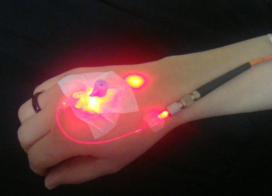 Bir ayağınız diğerinden büyükse dikkatli olun; tek taraflı şişlik lenfödem belirtisi olabilir.